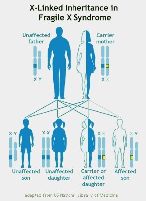 Fragile X Syndrome Inheritance